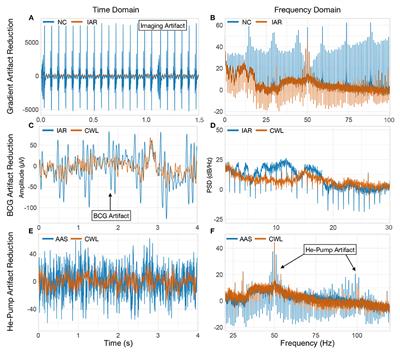 Evaluation and comparison of most prevalent artifact reduction methods for EEG acquired simultaneously with fMRI